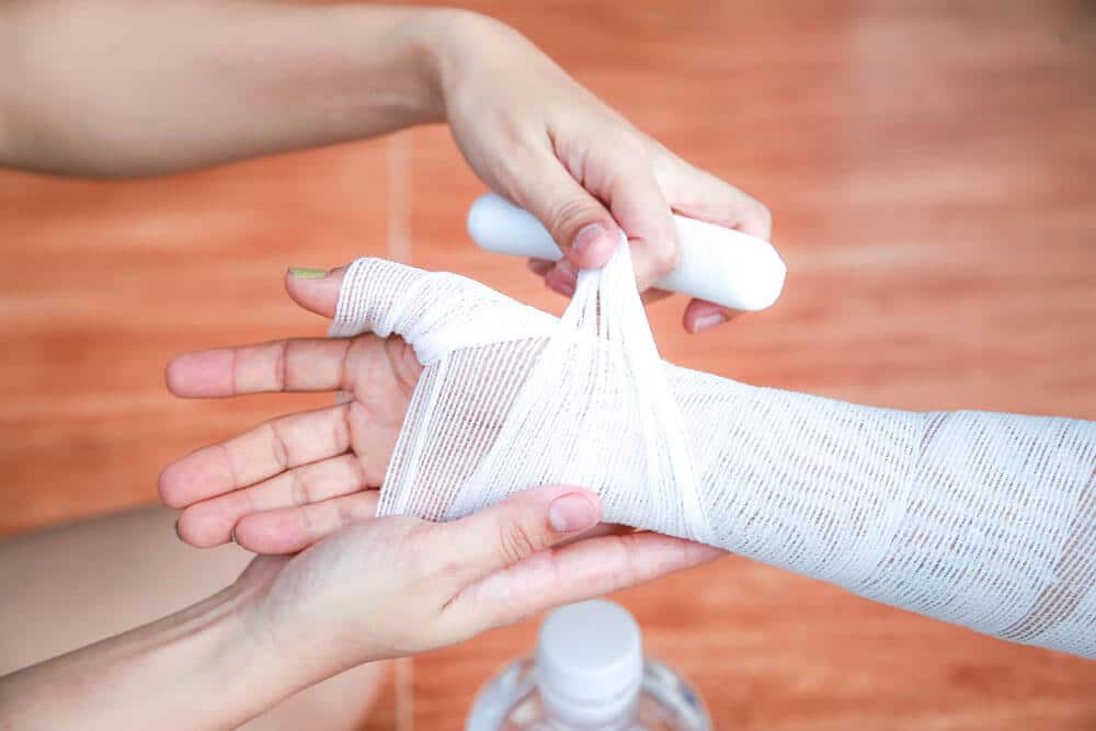 burn injury lawyer south florida