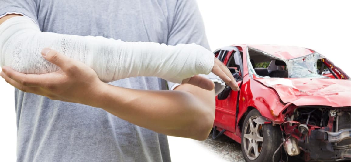 man with a broken arm injury after an auto accident in Florida